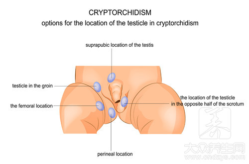 左睾丸隱痛是怎麼回事呢